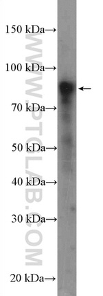 SUN2 Antibody in Western Blot (WB)