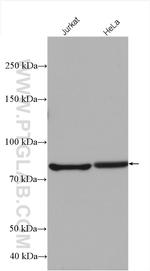 SUN2 Antibody in Western Blot (WB)