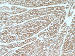 Calsequestrin 2 Antibody in Immunohistochemistry (Paraffin) (IHC (P))