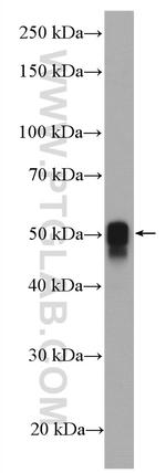 Calsequestrin 2 Antibody in Western Blot (WB)