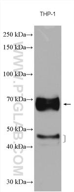 CD64 Antibody in Western Blot (WB)