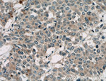 TAB1 Antibody in Immunohistochemistry (Paraffin) (IHC (P))