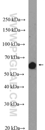 TAB1 Antibody in Western Blot (WB)