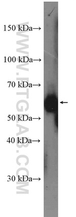 TAB1 Antibody in Western Blot (WB)