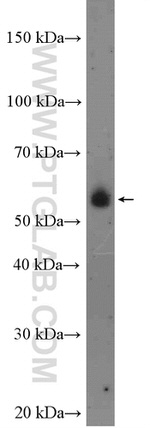 TAB1 Antibody in Western Blot (WB)