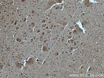 GABBR2 Antibody in Immunohistochemistry (Paraffin) (IHC (P))