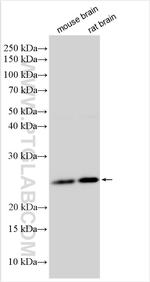 ANKRD46 Antibody in Western Blot (WB)