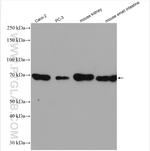 SLC6A19 Antibody in Western Blot (WB)
