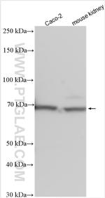 SLC6A19 Antibody in Western Blot (WB)