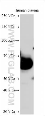 UST Antibody in Western Blot (WB)