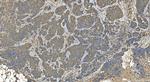 TRANK1 Antibody in Immunohistochemistry (Paraffin) (IHC (P))