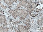 C3orf64 Antibody in Immunohistochemistry (Paraffin) (IHC (P))