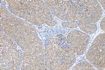 Fibroblast activation protein alpha Antibody in Immunohistochemistry (Paraffin) (IHC (P))