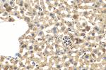 Fibroblast activation protein alpha Antibody in Immunohistochemistry (Paraffin) (IHC (P))