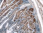 LRBA Antibody in Immunohistochemistry (Paraffin) (IHC (P))