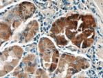 LRBA Antibody in Immunohistochemistry (Paraffin) (IHC (P))
