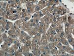 CIDEB Antibody in Immunohistochemistry (Paraffin) (IHC (P))