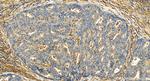 ASPN Antibody in Immunohistochemistry (Paraffin) (IHC (P))