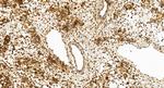 SIK2 Antibody in Immunohistochemistry (Paraffin) (IHC (P))