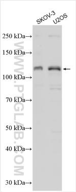 SIK2 Antibody in Western Blot (WB)