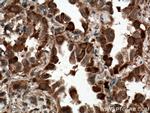 C21orf2 Antibody in Immunohistochemistry (Paraffin) (IHC (P))