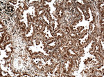 C21orf2 Antibody in Immunohistochemistry (Paraffin) (IHC (P))