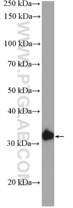 C21orf2 Antibody in Western Blot (WB)