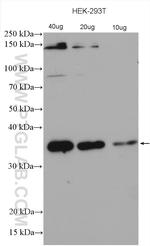 C21orf2 Antibody in Western Blot (WB)