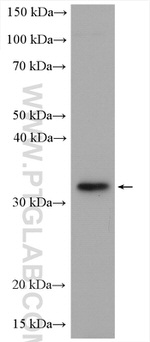 C21orf2 Antibody in Western Blot (WB)