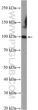 FBXO11 Antibody in Western Blot (WB)