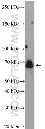E2F3 Antibody in Western Blot (WB)