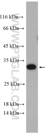 DBNDD2 Antibody in Western Blot (WB)
