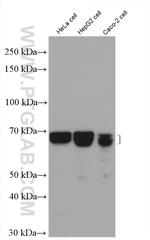 CHAF1B Antibody in Western Blot (WB)