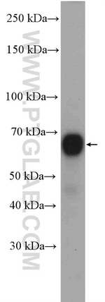 CHAF1B Antibody in Western Blot (WB)