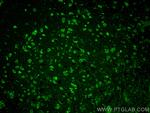 SLC38A6 Antibody in Immunohistochemistry (PFA fixed) (IHC (PFA))