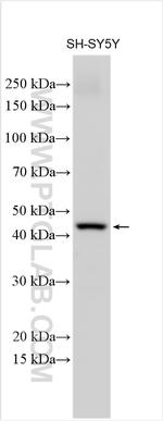SLC38A6 Antibody in Western Blot (WB)