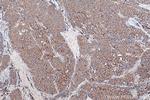 TPD52 Antibody in Immunohistochemistry (Paraffin) (IHC (P))