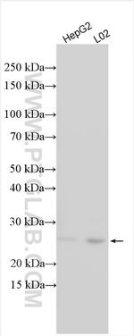 TPD52 Antibody in Western Blot (WB)