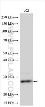 TPD52 Antibody in Western Blot (WB)