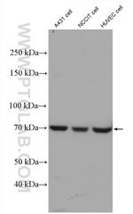 HIF3A Antibody in Western Blot (WB)
