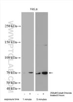 HIF3A Antibody in Western Blot (WB)
