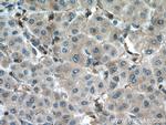 DPYD Antibody in Immunohistochemistry (Paraffin) (IHC (P))