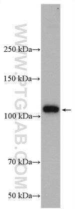DPYD Antibody in Western Blot (WB)