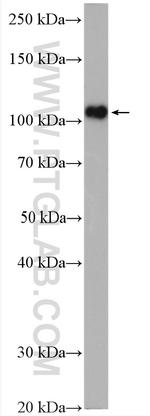 DPYD Antibody in Western Blot (WB)