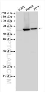 RSL1D1 Antibody in Western Blot (WB)