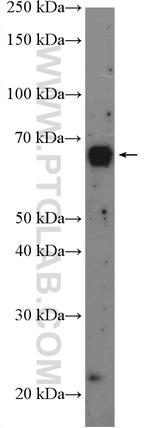 RCOR1 Antibody in Western Blot (WB)