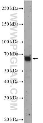 RCOR1 Antibody in Western Blot (WB)