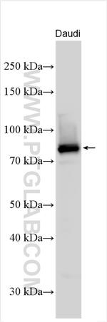 REL Antibody in Western Blot (WB)