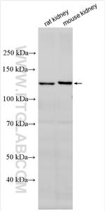 Cadherin-6 Antibody in Western Blot (WB)