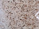 TMEM85 Antibody in Immunohistochemistry (Paraffin) (IHC (P))